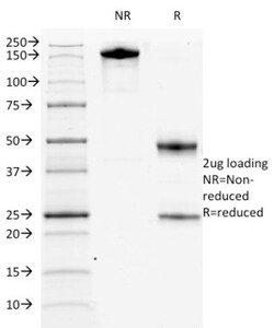 CD117/c-kit Antibody (KIT/982), Novus Biologicals 0.2mg; Unlabeled:Antibodies,